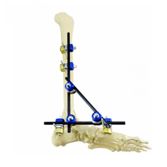 Hoffman external fixator/combination external fixation bracket